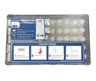 1-microglobulin ( α 1-mg ) اختبار